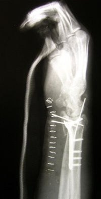 wrist_hardware.jpg